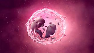 Eosinophil in Chronic Rhinosinusitis with Nasal Polyps illustration